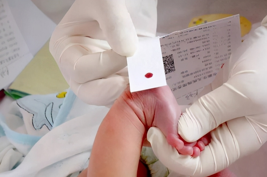 云南省医院做亲子鉴定需要检材有哪几种,云南省医院做亲子鉴定需要检材有哪几种